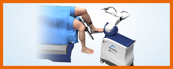 Mako Robotic-Arm Assisted Total Knee replacement 
